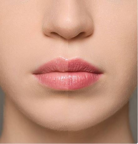 Supreme Lip Treatment – Fraise - Cod.: MM003